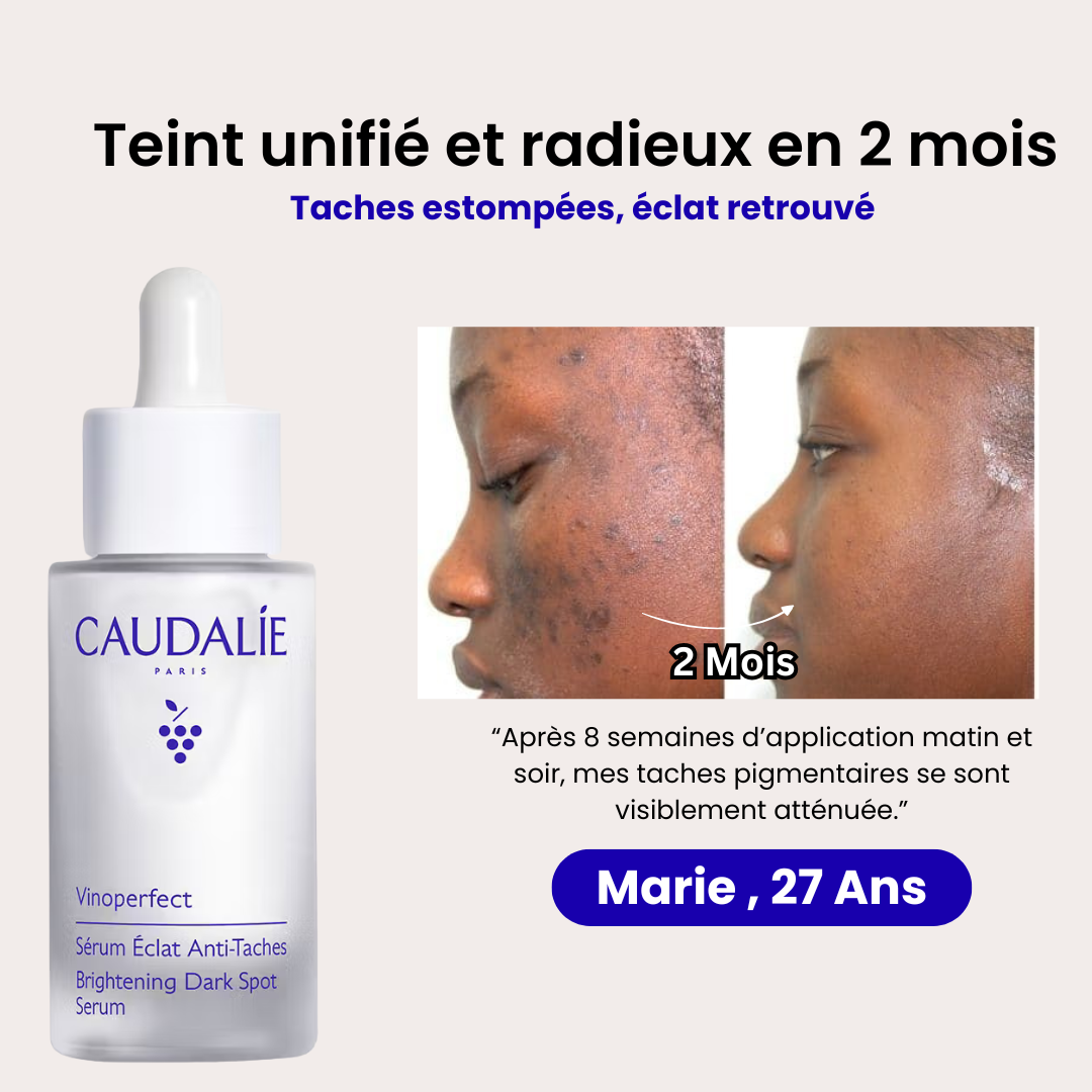 Sérum Vinoperfect : la solution pour un teint uniforme et des taches estompées.