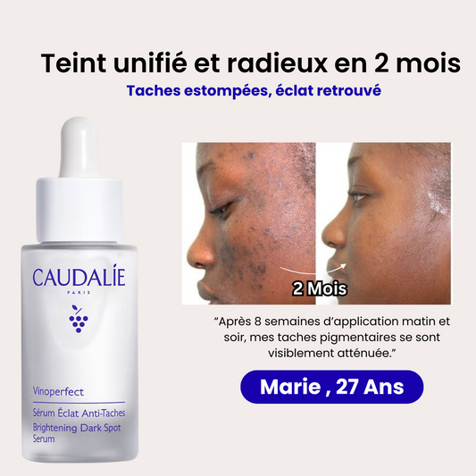 Sérum Vinoperfect : la solution pour un teint uniforme et des taches estompées.